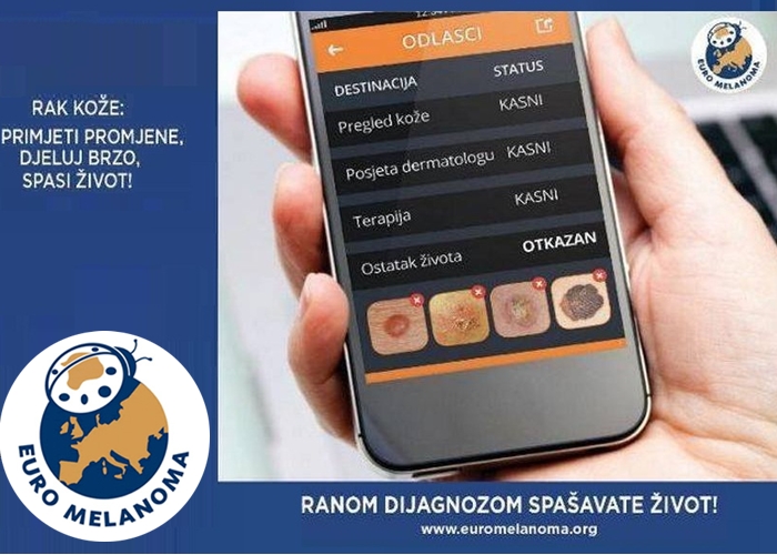 Euromelanoma 2015. – Ranom dijagnozom spašavate život